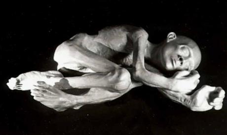 Das verhungerte Kind (1993) - Hajo Horstmann - Hajo Horstmann -  auf  - Array - 
