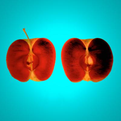 Xray Apple - Theo Berends - Array auf - Array - Xray Apple - Theo Berends - Array auf - Array -